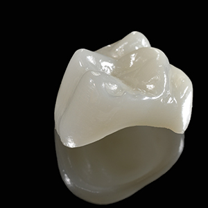 Dental Crowns