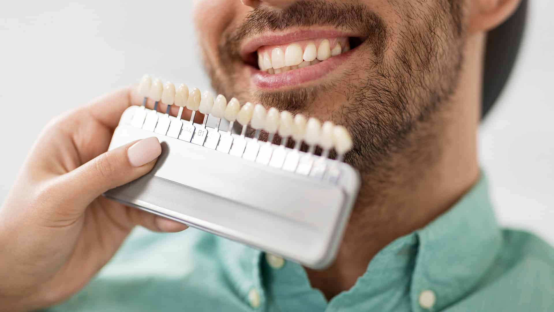 Colors of Dental Crowns
