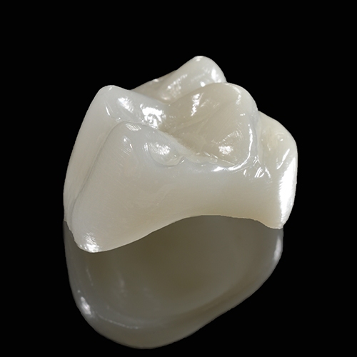 Dental Crowns