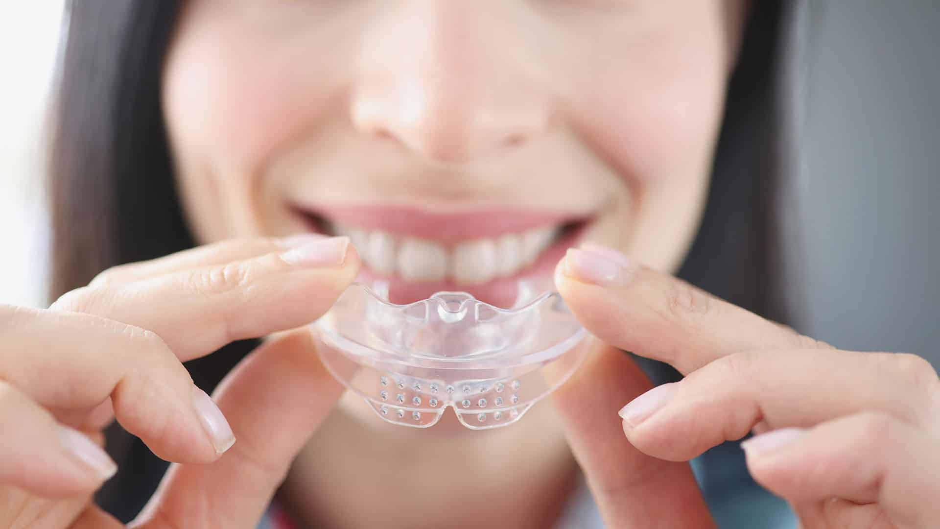 Athletic Mouthguards at Polished Smiles