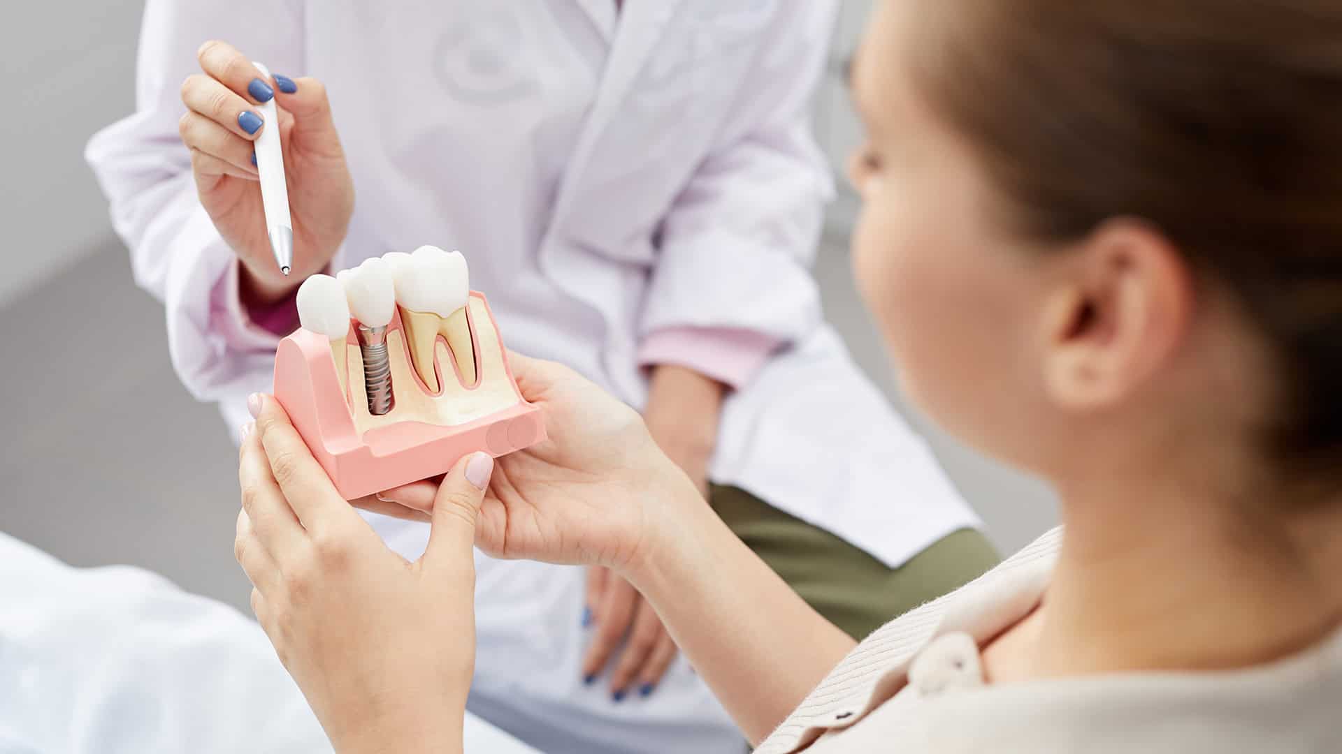 Dental Implant Procedure at Polished Dentistry
