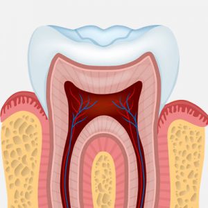 Root Canal Diagram