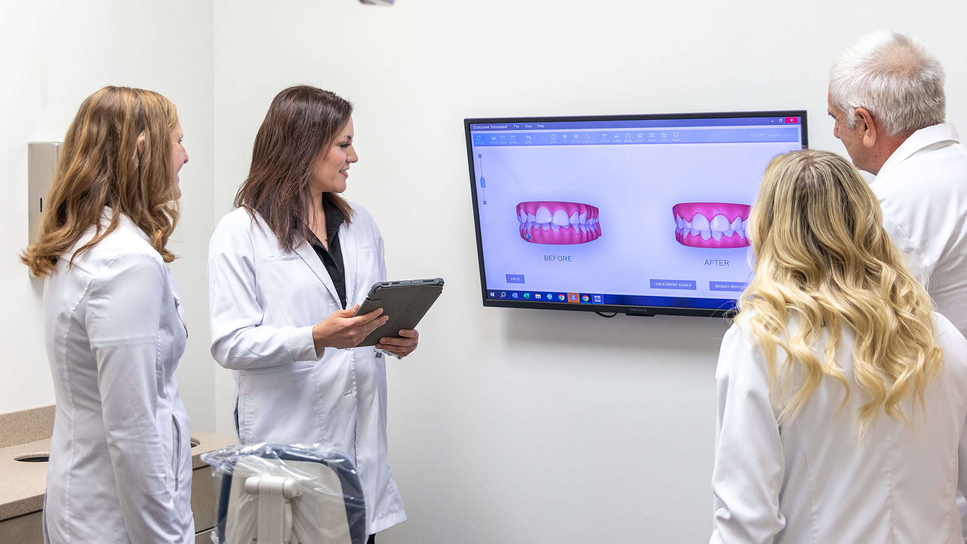 Dentists Reviewing Dental Bonding Before and After Scan