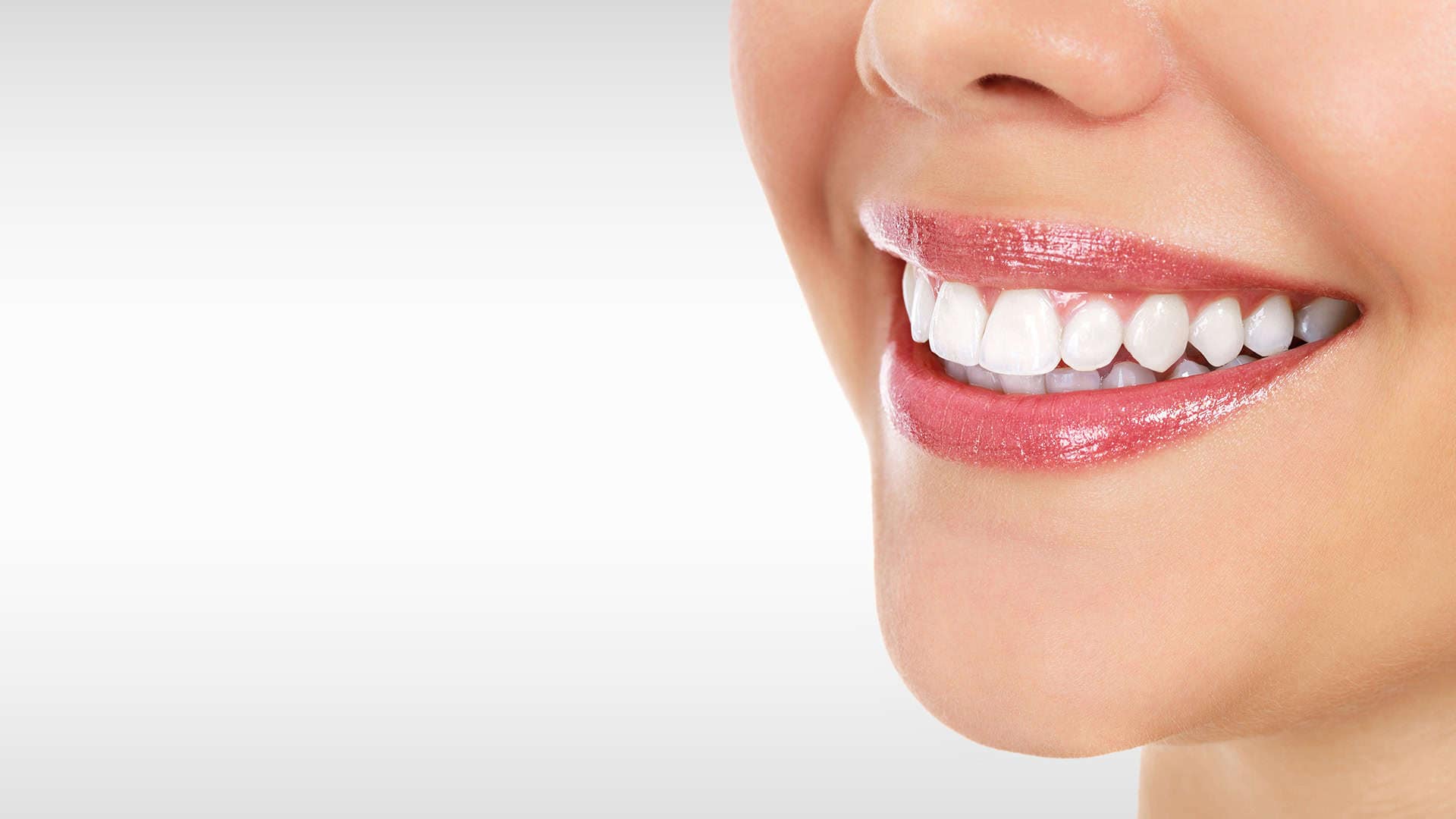Woman Smiling With New Veneers
